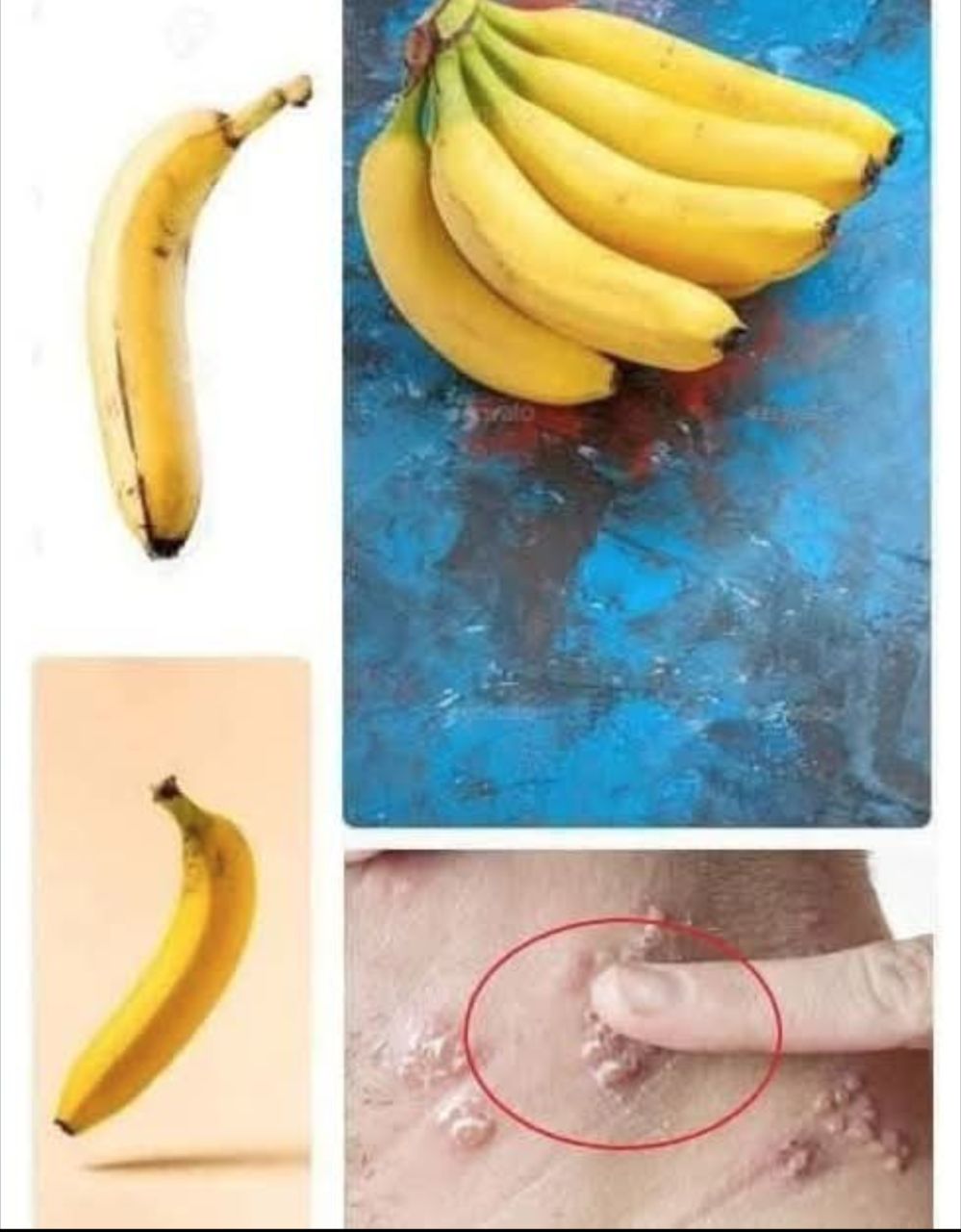 Did You Know That If You Eat a Banana Every Day, Your Body Can… See more